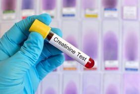 Xét nghiệm Creatinin và những câu hỏi thường gặp