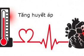 PHÒNG NGỪA VÀ ĐIỀU TRỊ TĂNG HUYẾT ÁP