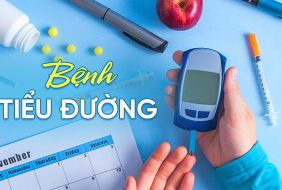TIÊU CHUẨN CHẨN ĐOÁN ĐÁI THÁO ĐƯỜNG THEO ADA 2022