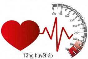 NHỮNG ĐIỀU CẦN BIẾT VỀ TĂNG HUYẾT ÁP