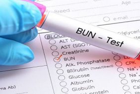 Xét nghiệm BUN là gì? Ý nghĩa xét nghiệm BUN