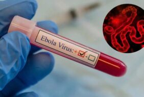 CHỦ ĐỘNG PHÒNG NGỪA BỆNH DO VI RÚT EBOLA – KHÔNG HOANG MANG, KHÔNG CHỦ QUAN