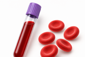 Chỉ số HbA1c